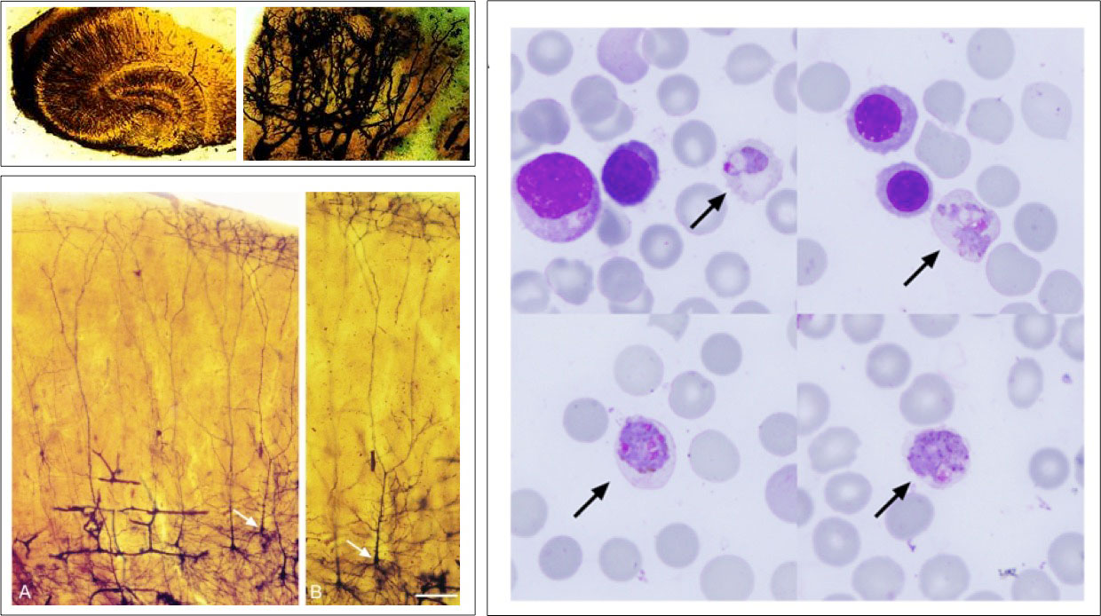 Imagen de neuronas teñidas por Golgi, Cajal y tinción Giemsa.