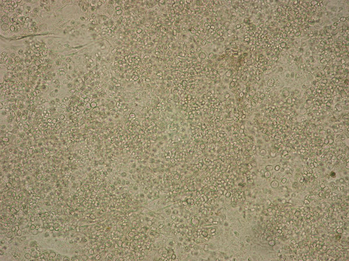 Epidermis de un anfibio infectado por Bd durante la llegada del hongo a El Cope, Panamá, 2004. Las células redondeadas pertenecen a Bd, mientras que las células más irregulares de color verde grisáceo son parte de la piel del anfibio. Foto: Forrest Brem.