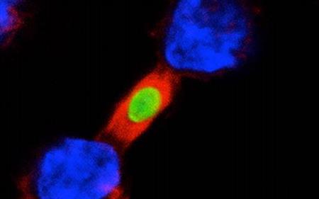 Dos macrófagos,  en azul, engullendo al mismo patógeno, verde. Créditos: UC San Diego Heath