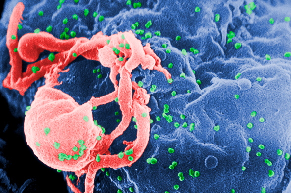 CRÉDITOS: C. GoldsmithContent Providers: CDC/ C. Goldsmith, P. Feorino, E. L. Palmer, W. R. McManus - This media comes from the Centers for Disease Control and Prevention's Public Health Image Library (PHIL)