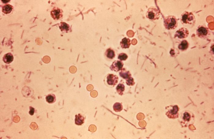 Imagen al microscópio de Shigella dysenteriae