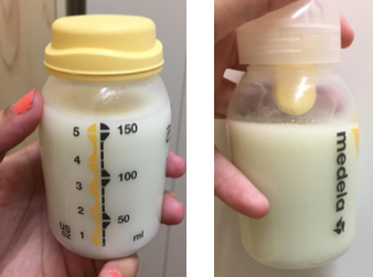 A la izquierda, leche de color blanco. A la derecha, leche más amarilla. La extracción de esta última se produjo un día en el que el bebé estaba con fiebre y acatarrado.